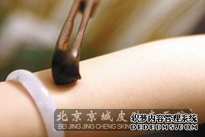 生活中治疗皮肤瘙痒的偏方