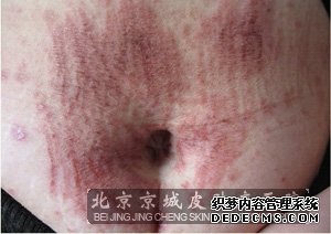 呼和浩特肤康治疗皮肤瘙痒哪家医院好