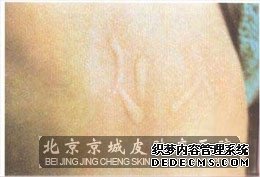 缓解皮肤出现瘙痒的方法