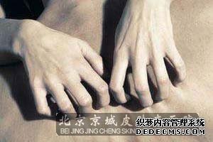 皮肤瘙痒症如何用药治疗